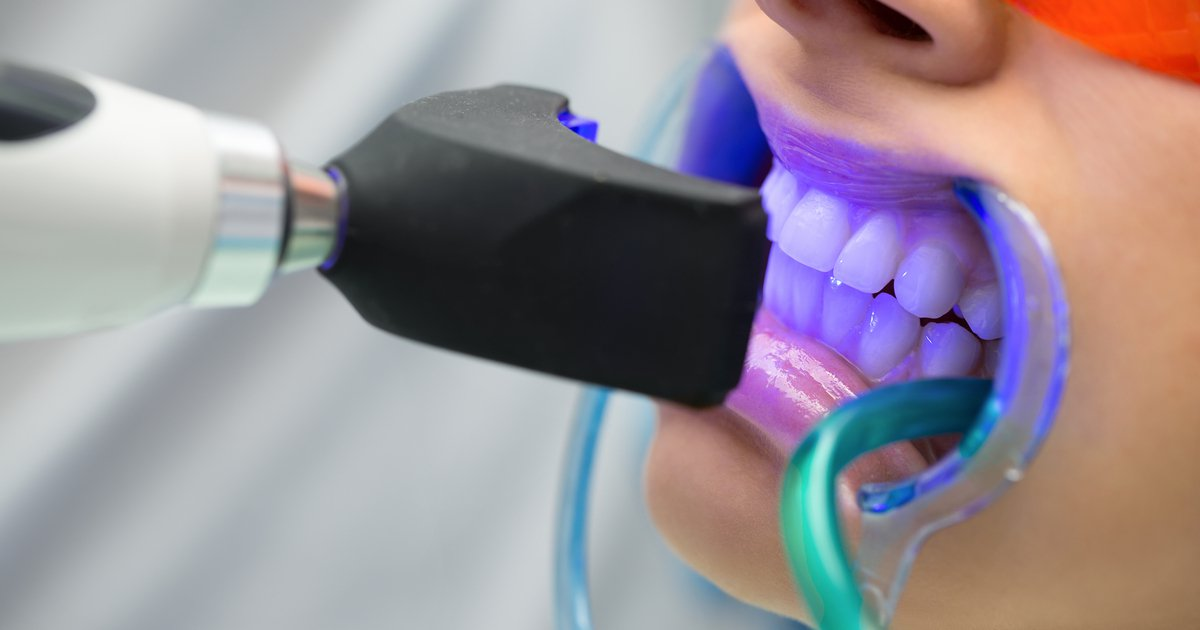 Paquete Blanqueamiento Premium