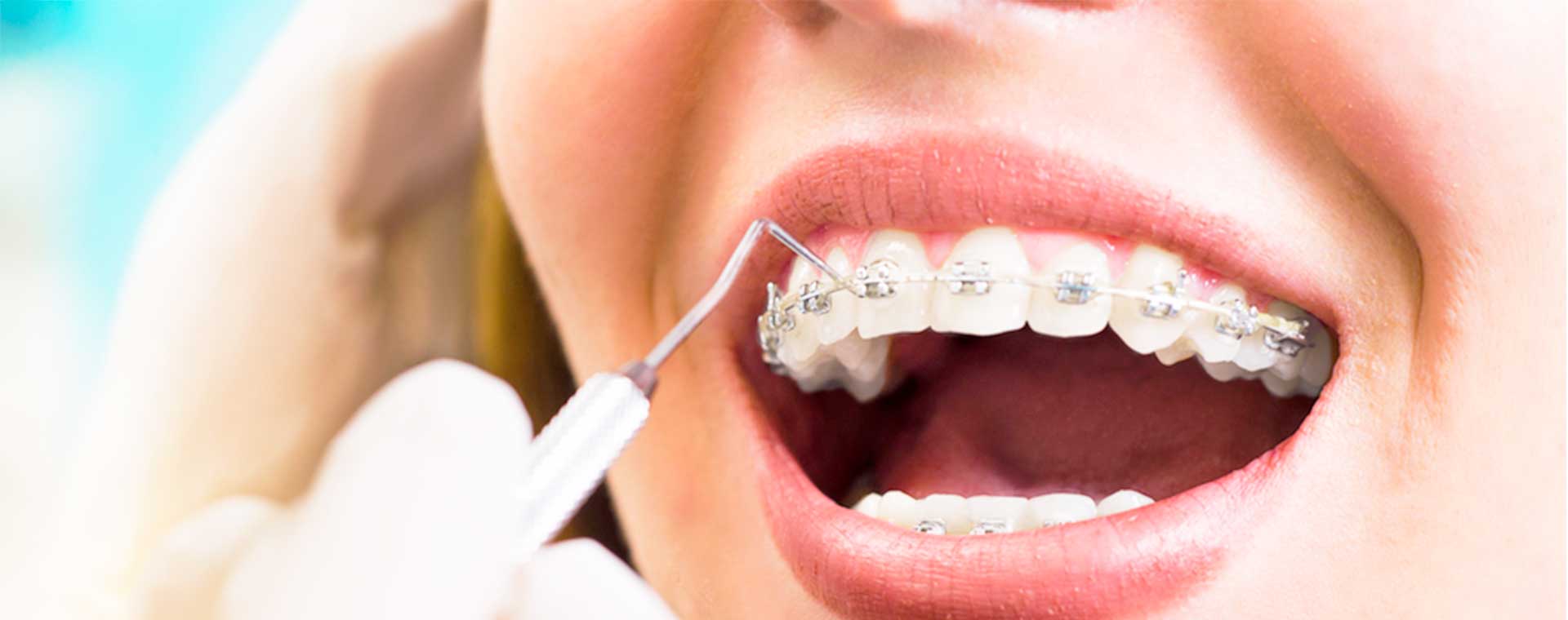 Promocion Ortodoncia